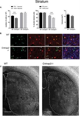 Dysregulation of Parvalbumin Expression in the Cntnap2−/− Mouse Model of Autism Spectrum Disorder